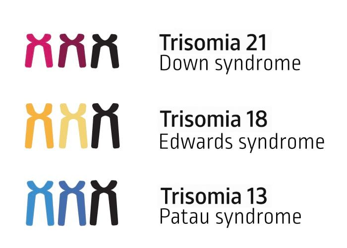 Trisomie
